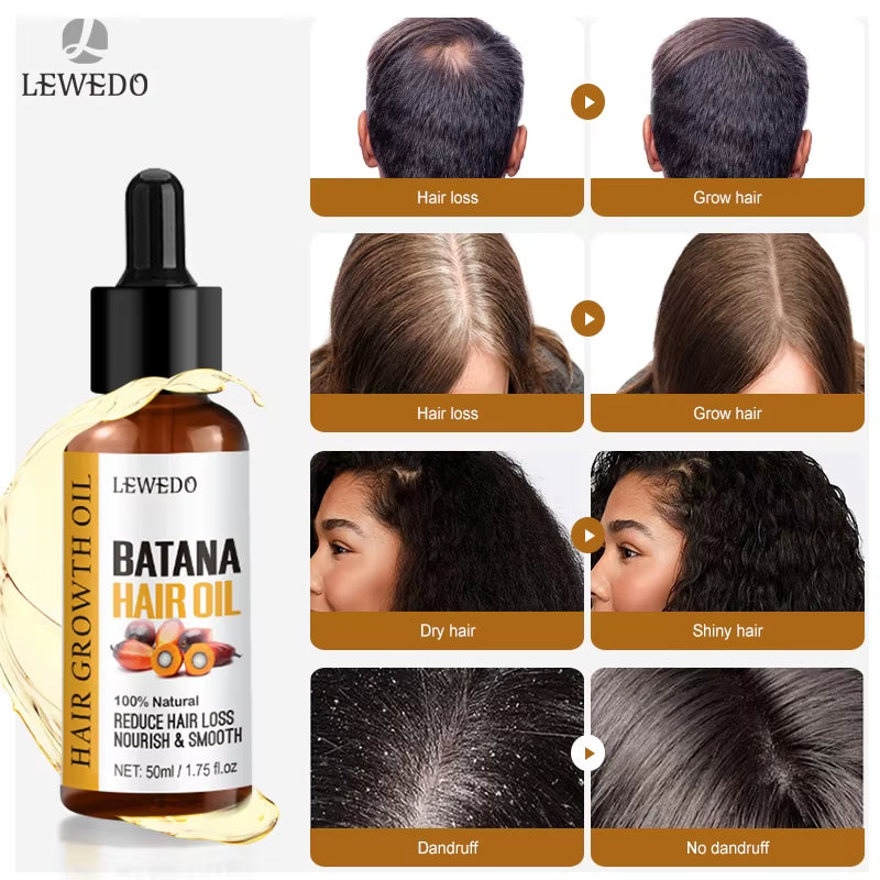 Natural 100% Pure Batana Oil for Hair Growth Batana Oil Butter Hair Mask from Honduras Hair Loss Treatment for Black Men & Women