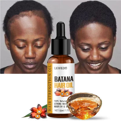 Naturals Batana Oil Fast Hair Growth for Men Women Pure Batana Oil Nourish Shiny Hair Healthy Hair Care anti Hair Loss